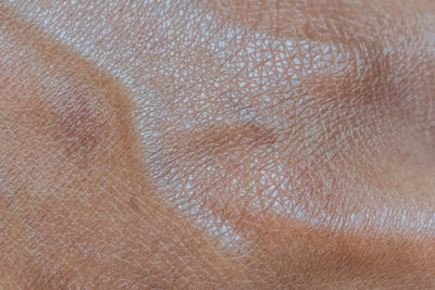 Gestresste Haut: CBD bei Juckreiz,  Trockenheit und Rötungen? (Lesezeit: 10min)
